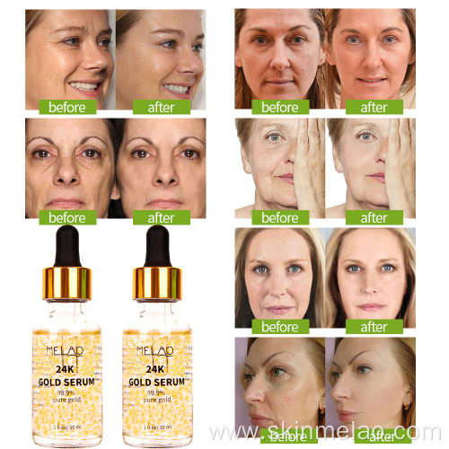 24k Gold Serum Anti Aging Face Collagen Serum